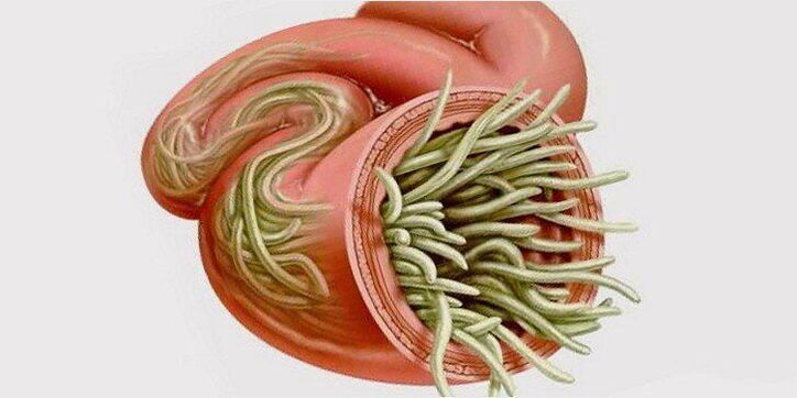 Würmer am Darm