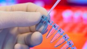 Wéi kritt Dir fir Parasiten getest