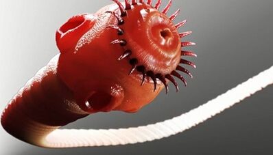 Aarte vu Parasiten am mënschleche Kierper