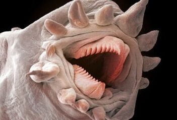 wat Würmer kënnen am mënschleche Kierper liewen