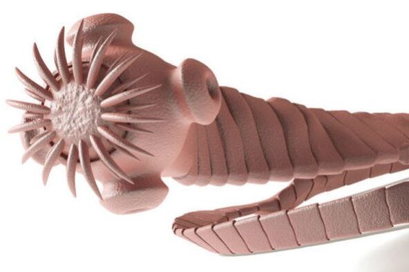 Parasit aus dem mënschleche Kierper