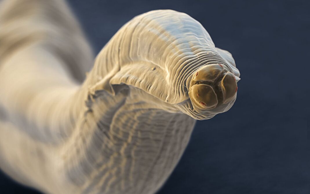 toxocara aus dem mënschleche Kierper