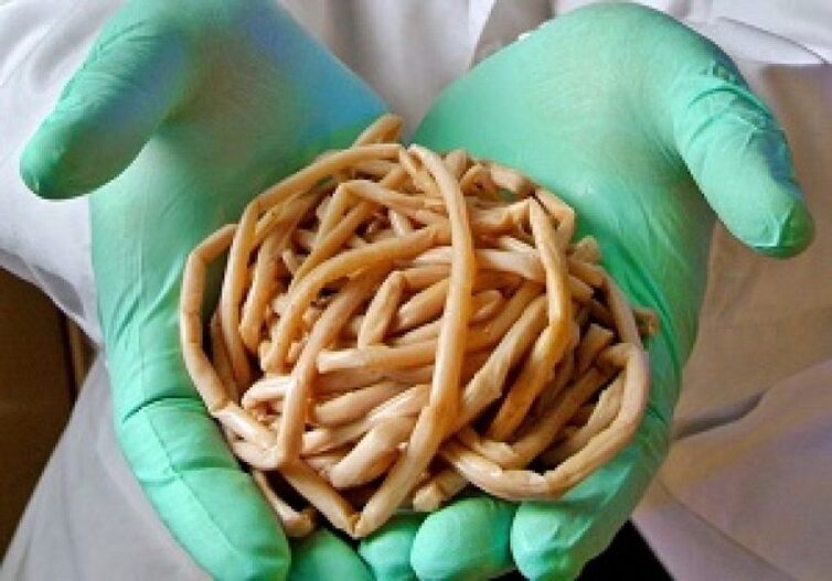 Parasitäre Würmer aus dem mënschleche Kierper